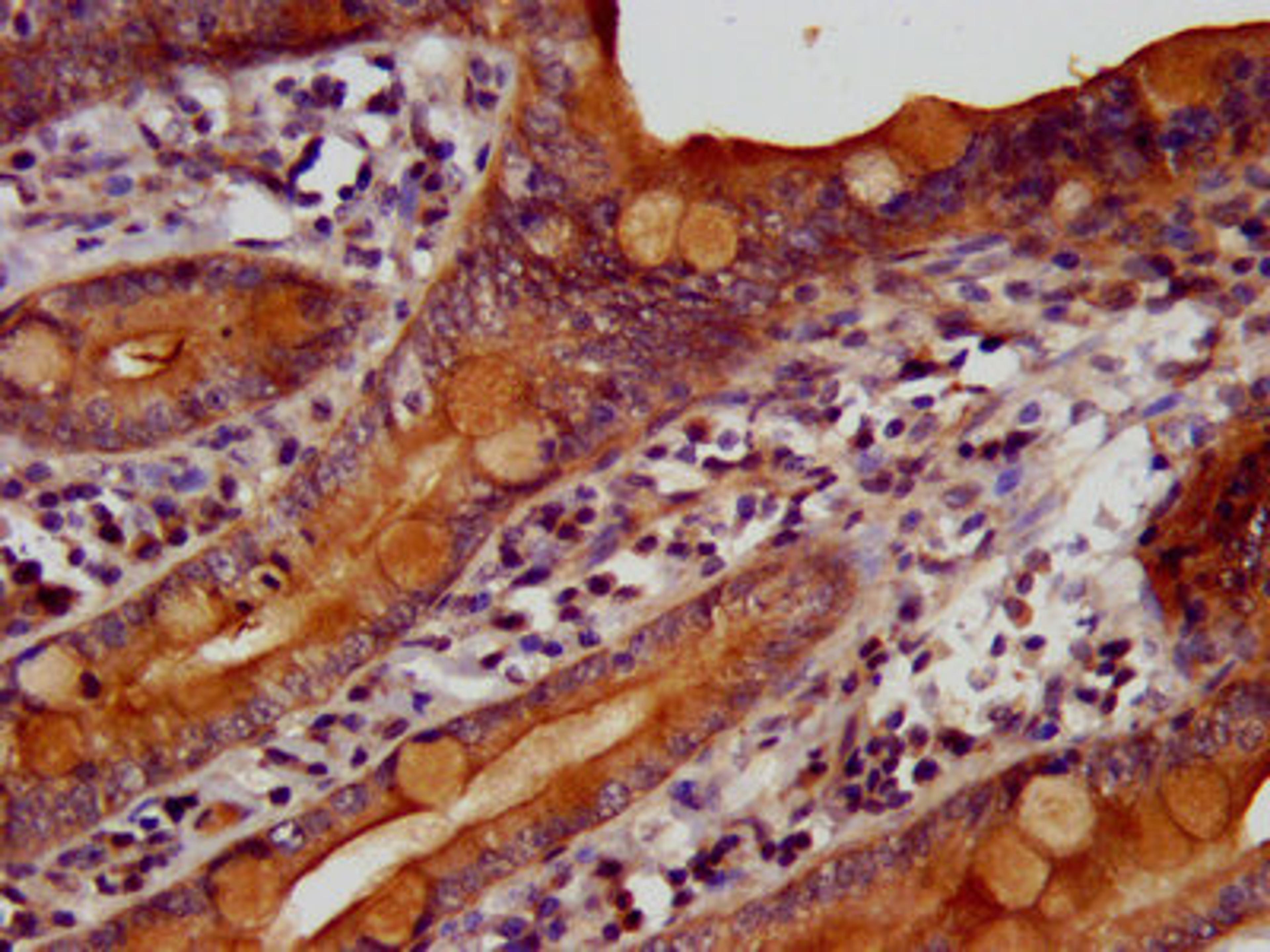 IHC image of CSB-PA659468LA01HU diluted at 1:400 and staining in paraffin-embedded human small intestine tissue performed on a Leica BondTM system. After dewaxing and hydration, antigen retrieval was mediated by high pressure in a citrate buffer (pH 6.0). Section was blocked with 10% normal goat serum 30min at RT. Then primary antibody (1% BSA) was incubated at 4&deg;C overnight. The primary is detected by a biotinylated secondary antibody and visualized using an HRP conjugated SP system.