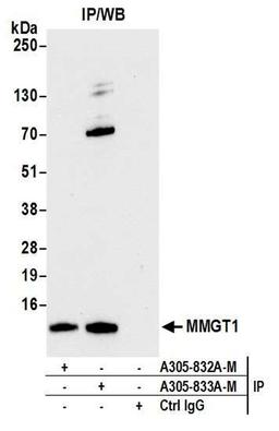 Detection of human MMGT1 by WB of IP.