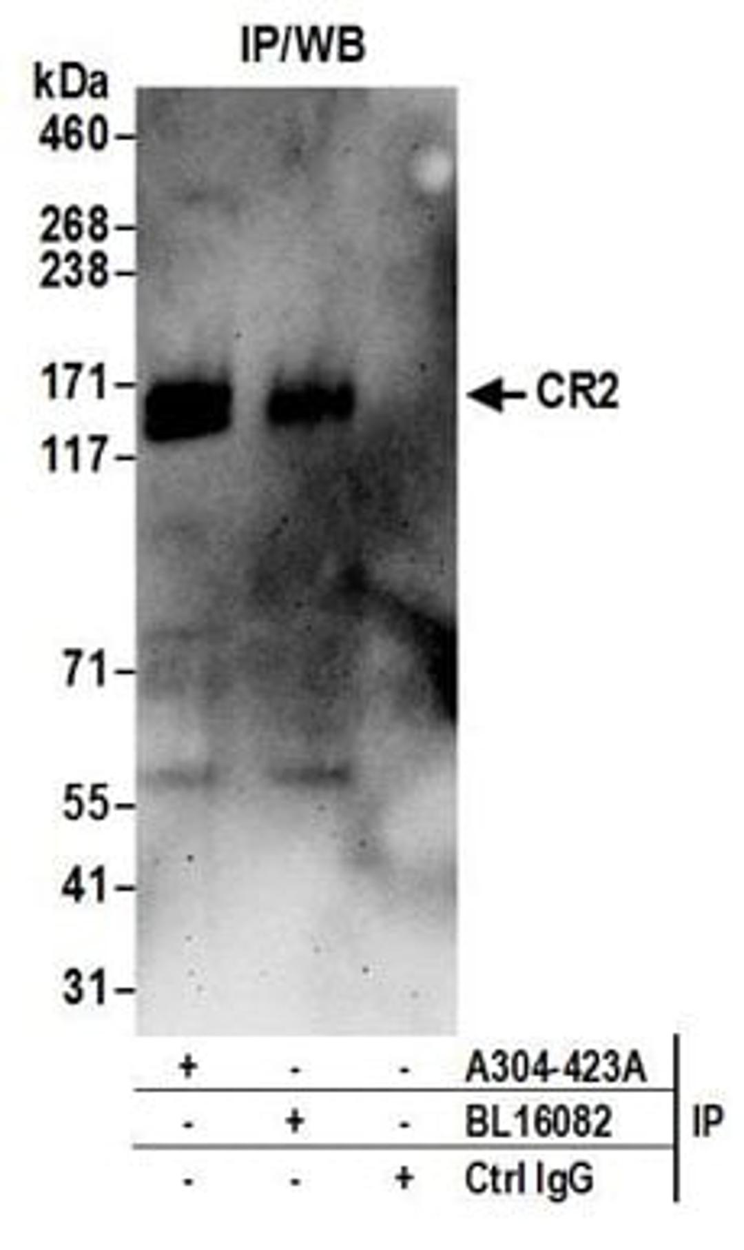 Detection of human CR2 by western blot of immunoprecipitates.