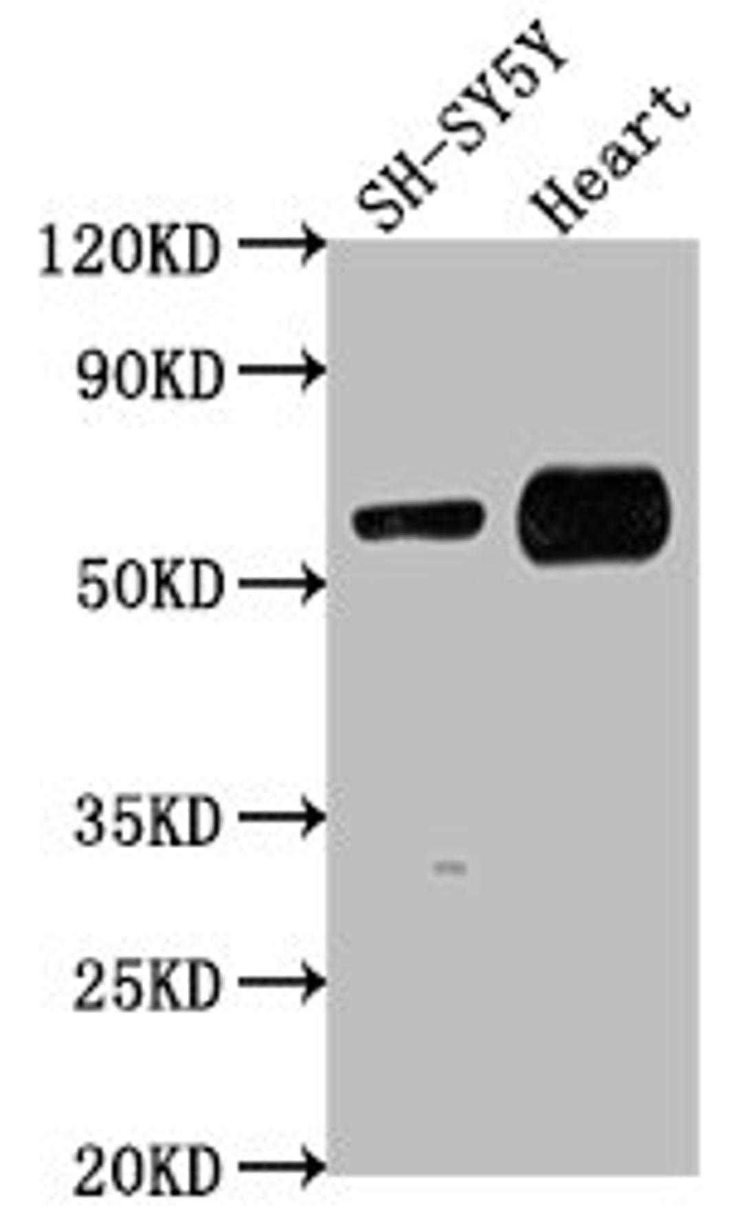 Western Blot. Positive WB detected in: SH-SY5Y whole cell lysate, Mouse heart tissue. All lanes: JRK antibody at 1:1000. Secondary. Goat polyclonal to rabbit IgG at 1/50000 dilution. Predicted band size: 62, 63 kDa. Observed band size: 62 kDa