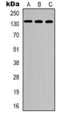 Western blot analysis of CEP135 expression in HEK293T (Lane 1), mouse lung (Lane 2), mouse heart (Lane 3) whole cell lysates using CEP135 antibody