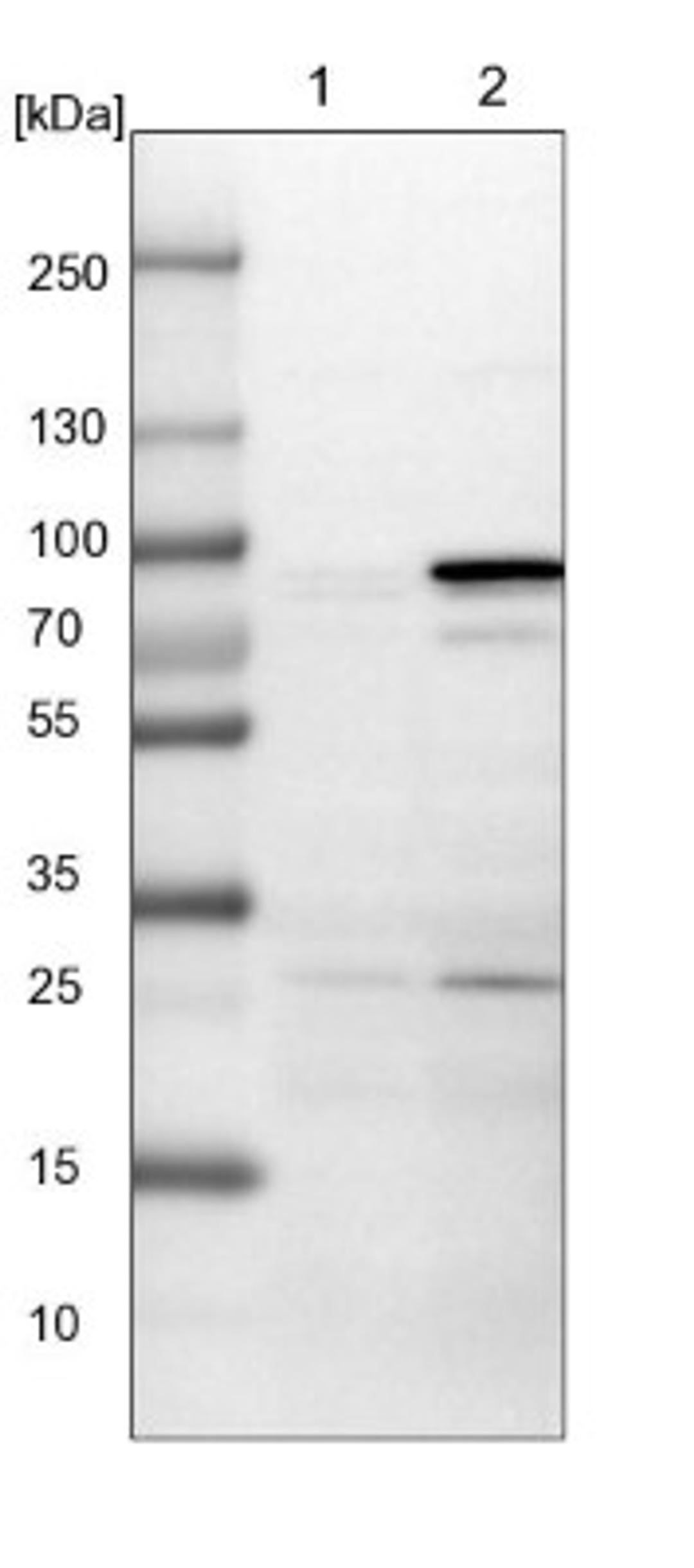 Western Blot: PARP6 Antibody [NBP1-87333] - Lane 1: NIH-3T3 cell lysate (Mouse embryonic fibroblast cells)<br/>Lane 2: NBT-II cell lysate (Rat Wistar bladder tumour cells)