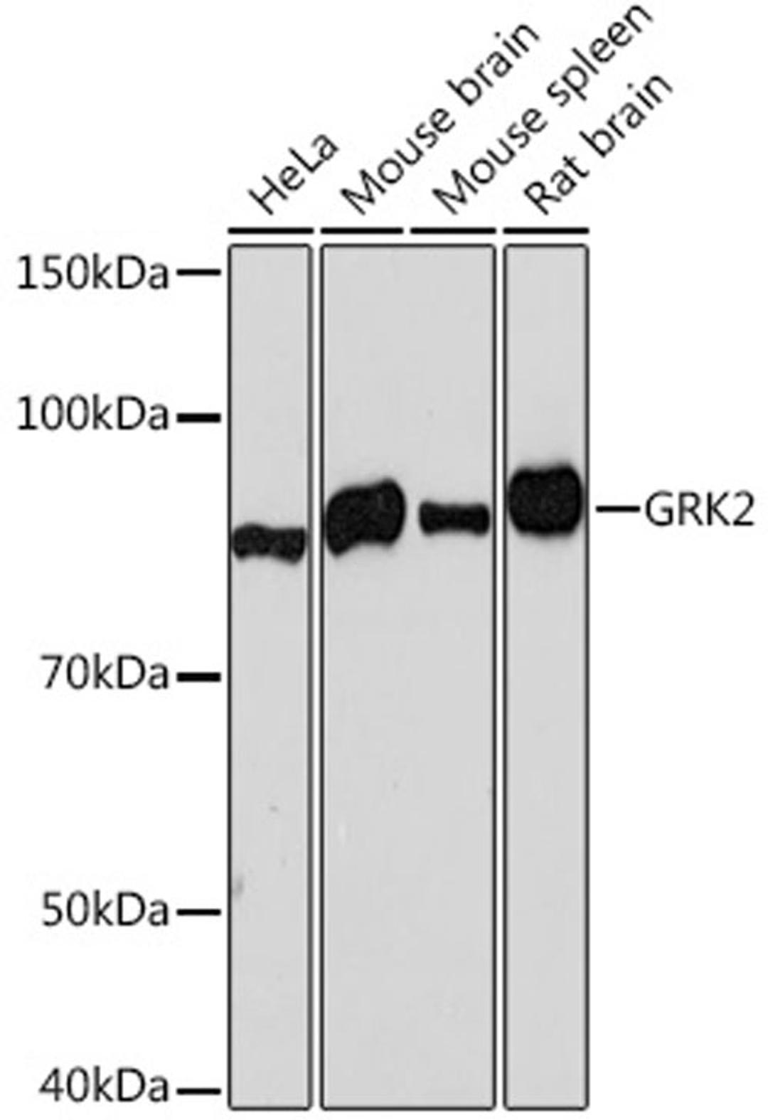 Western blot - GRK2 Rabbit mAb (A4443)