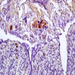 Immunohistochemical analysis of formalin-fixed paraffin embedded mouse colitis tissue using Cytomegalovirus PP65 antibody