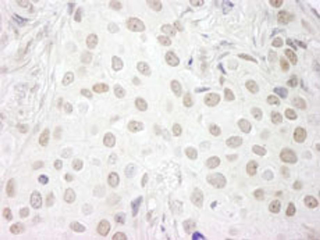 Detection of human PAF49 by immunohistochemistry.