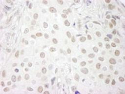 Detection of human PAF49 by immunohistochemistry.