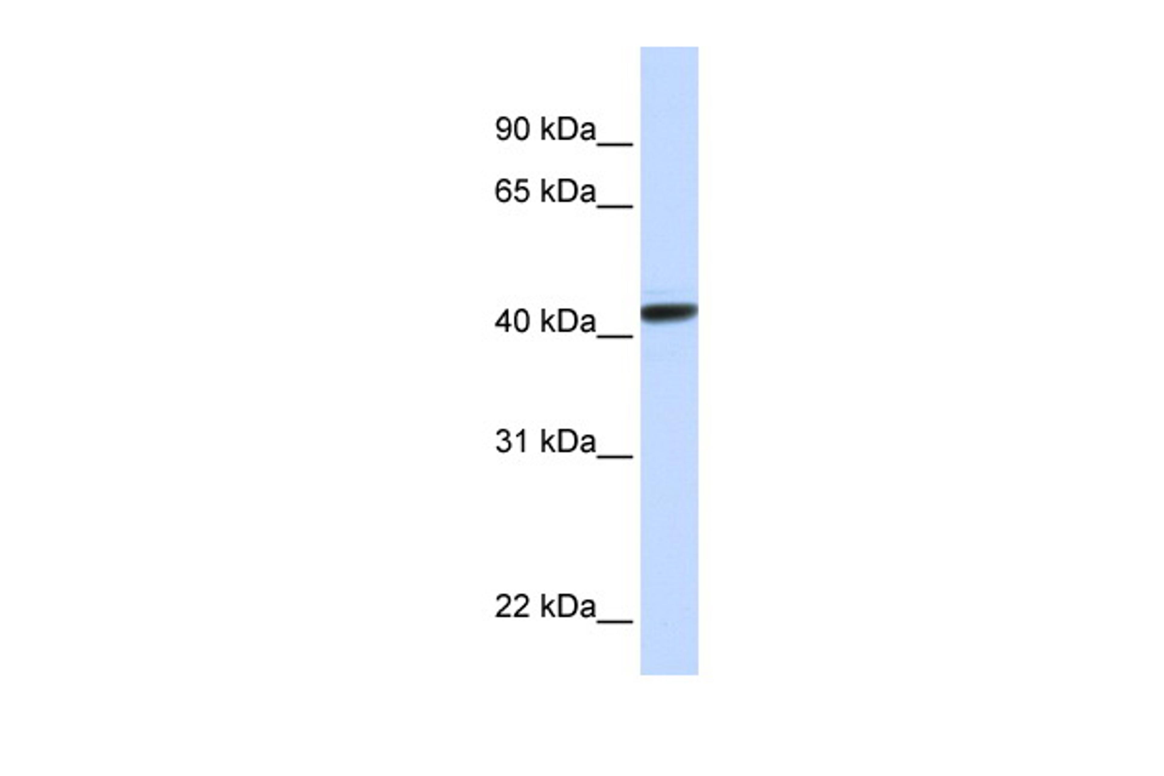 Antibody used in WB on Human HeLa at 0.2-1 ug/ml.