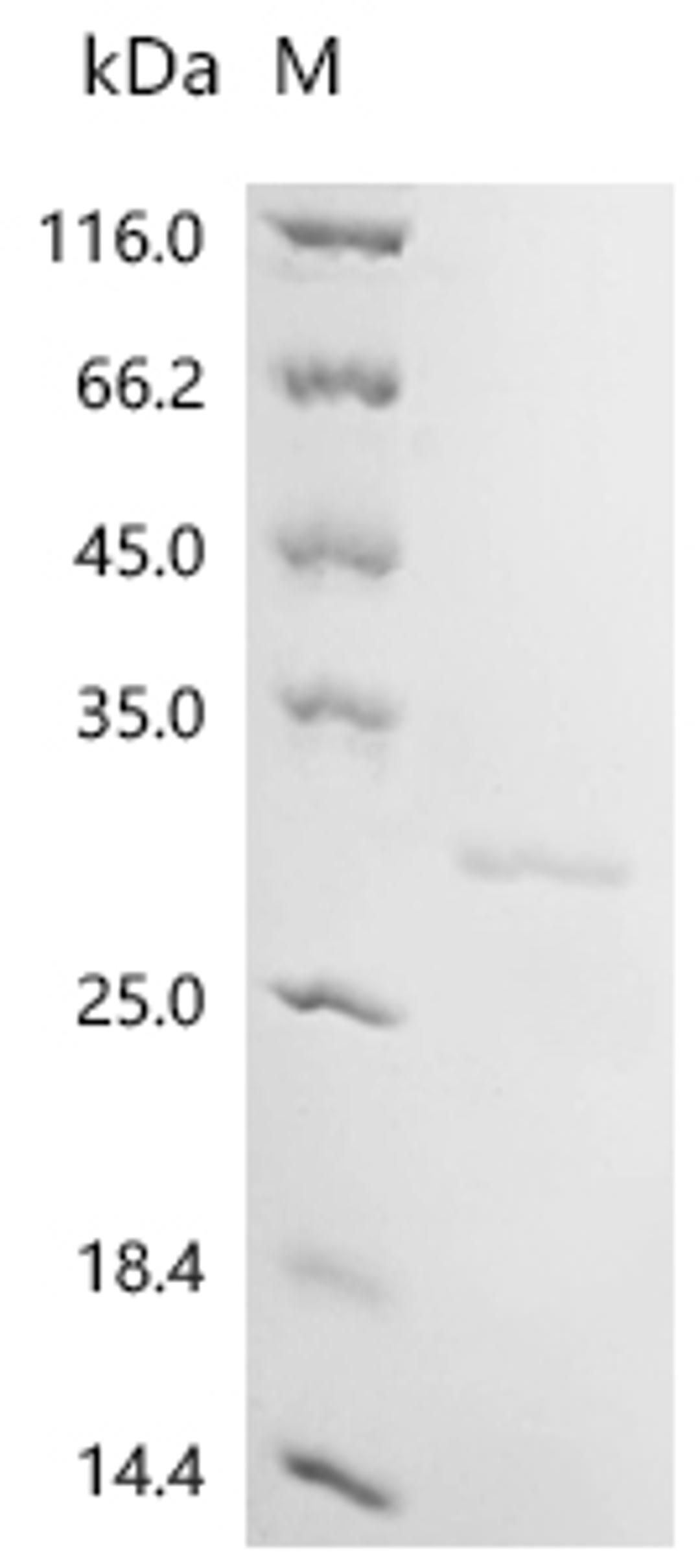 (Tris-Glycine gel) Discontinuous SDS-PAGE (reduced) with 5% enrichment gel and 15% separation gel.