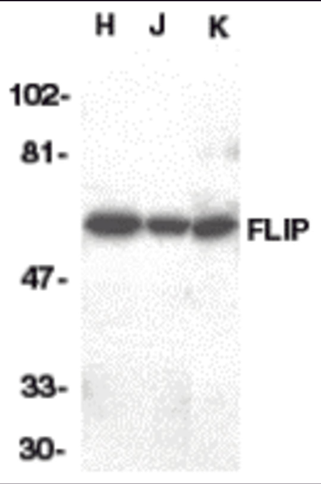 Western blot analysis of FLIP in HeLa (H), Jurkat (J), and K562 (K) whole cell lysate with FLIP antibody at 1:1000 dilution. 