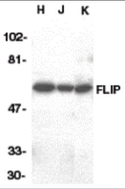 Western blot analysis of FLIP in HeLa (H), Jurkat (J), and K562 (K) whole cell lysate with FLIP antibody at 1:1000 dilution. 