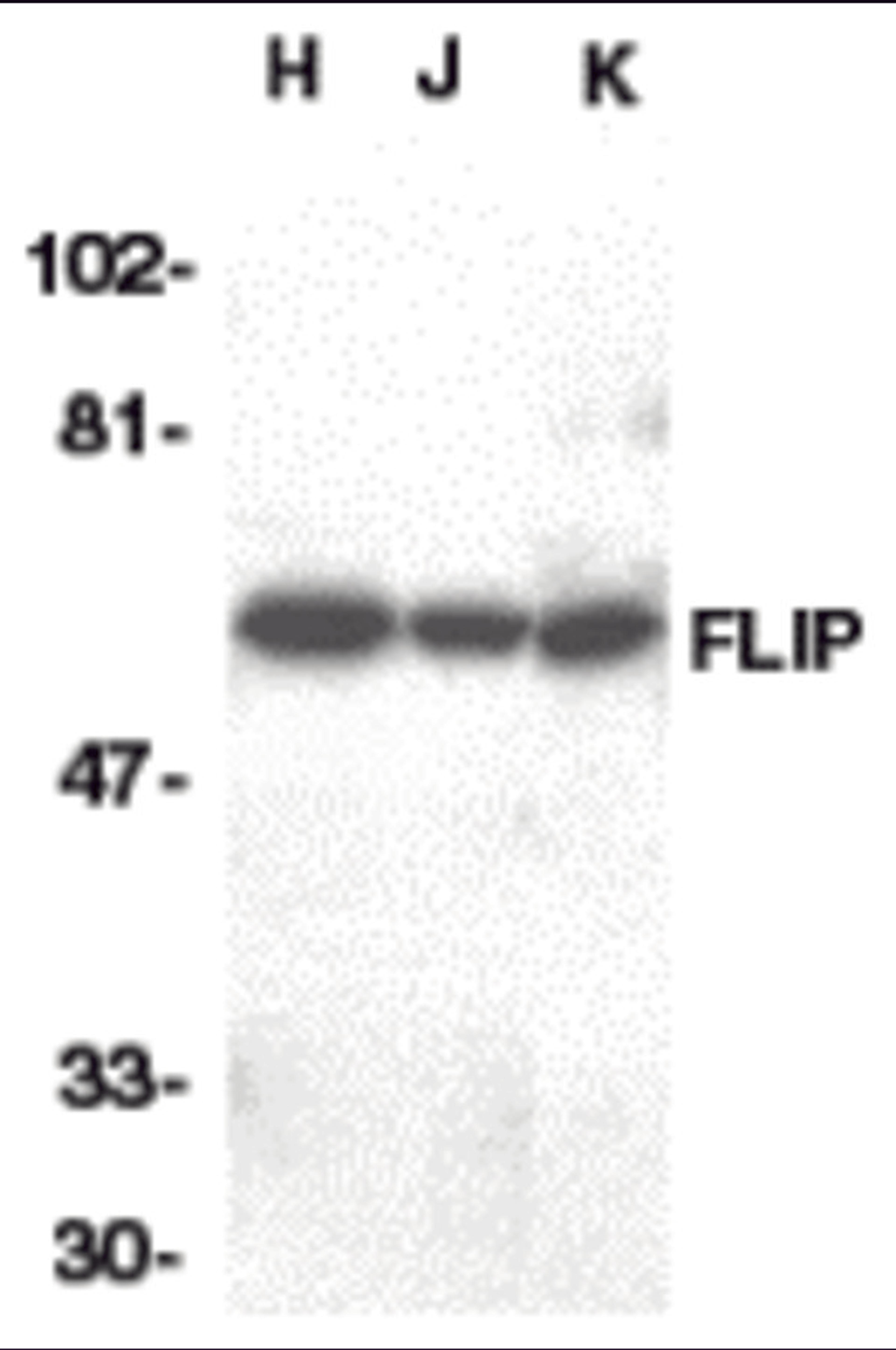 Western blot analysis of FLIP in HeLa (H), Jurkat (J), and K562 (K) whole cell lysate with FLIP antibody at 1:1000 dilution.