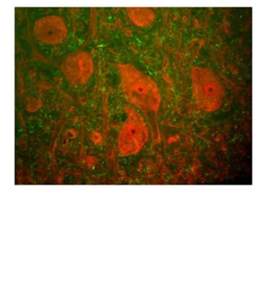 Immunostaining of rat spinal cord section with anti-mouse PGP9.5 and anti-neurofiliament H