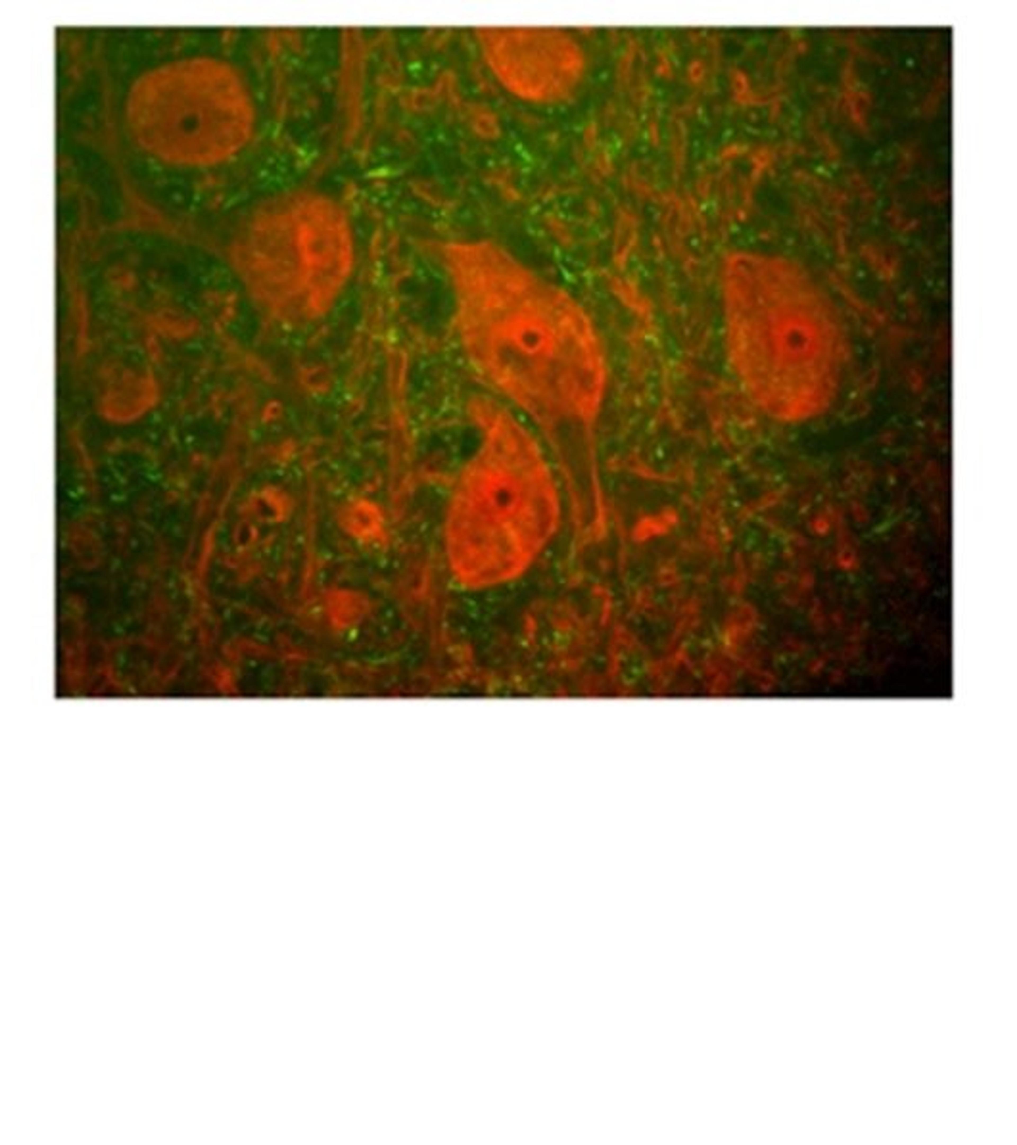 Immunostaining of rat spinal cord section with anti-mouse PGP9.5 and anti-neurofiliament H