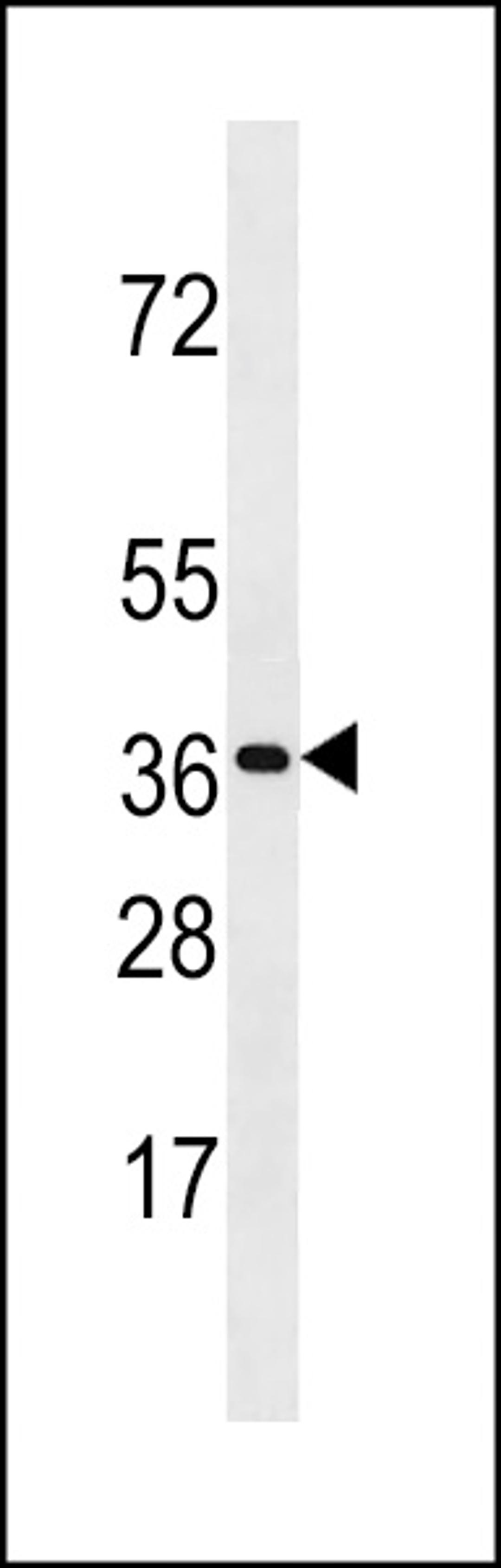 Western blot analysis in CEM cell line lysates (35ug/lane).