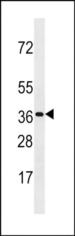 Western blot analysis in CEM cell line lysates (35ug/lane).