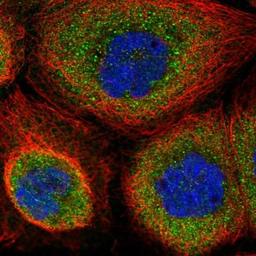 Immunocytochemistry/Immunofluorescence: WDR1 Antibody [NBP2-32665] - Immunofluorescent staining of human cell line A-431 shows positivity in cytoplasm.