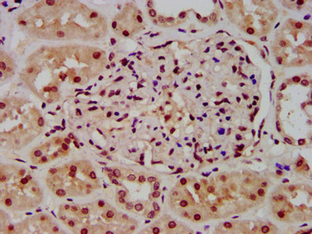 IHC image of CSB-PA010418OA23ncrHU diluted at 1:100 and staining in paraffin-embedded human kidney tissue performed on a Leica BondTM system. After dewaxing and hydration, antigen retrieval was mediated by high pressure in a citrate buffer (pH 6.0). Section was blocked with 10% normal goat serum 30min at RT. Then primary antibody (1% BSA) was incubated at 4°C overnight. The primary is detected by a biotinylated secondary antibody and visualized using an HRP conjugated SP system.