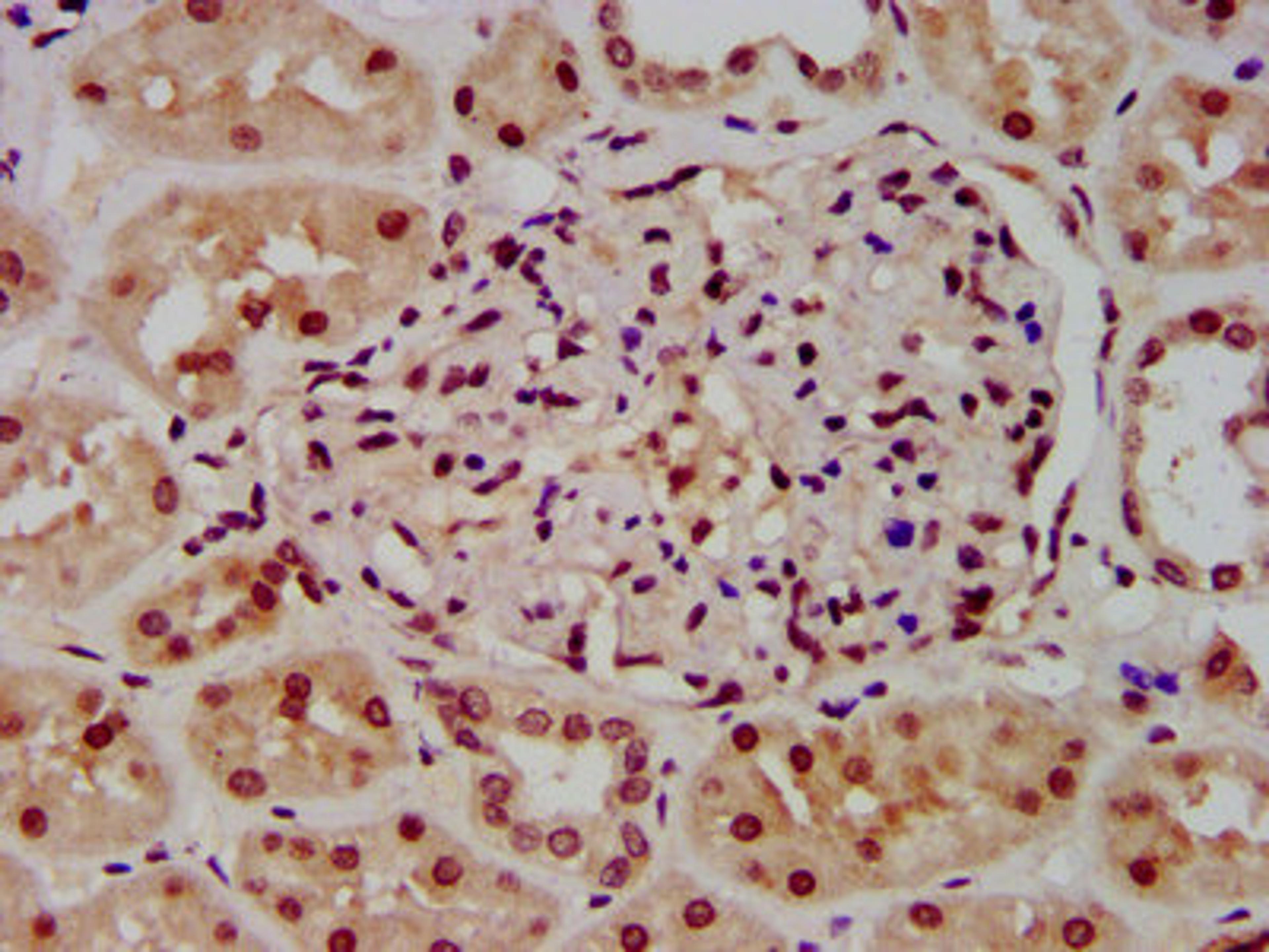 IHC image of CSB-PA010418OA23ncrHU diluted at 1:100 and staining in paraffin-embedded human kidney tissue performed on a Leica BondTM system. After dewaxing and hydration, antigen retrieval was mediated by high pressure in a citrate buffer (pH 6.0). Section was blocked with 10% normal goat serum 30min at RT. Then primary antibody (1% BSA) was incubated at 4°C overnight. The primary is detected by a biotinylated secondary antibody and visualized using an HRP conjugated SP system.
