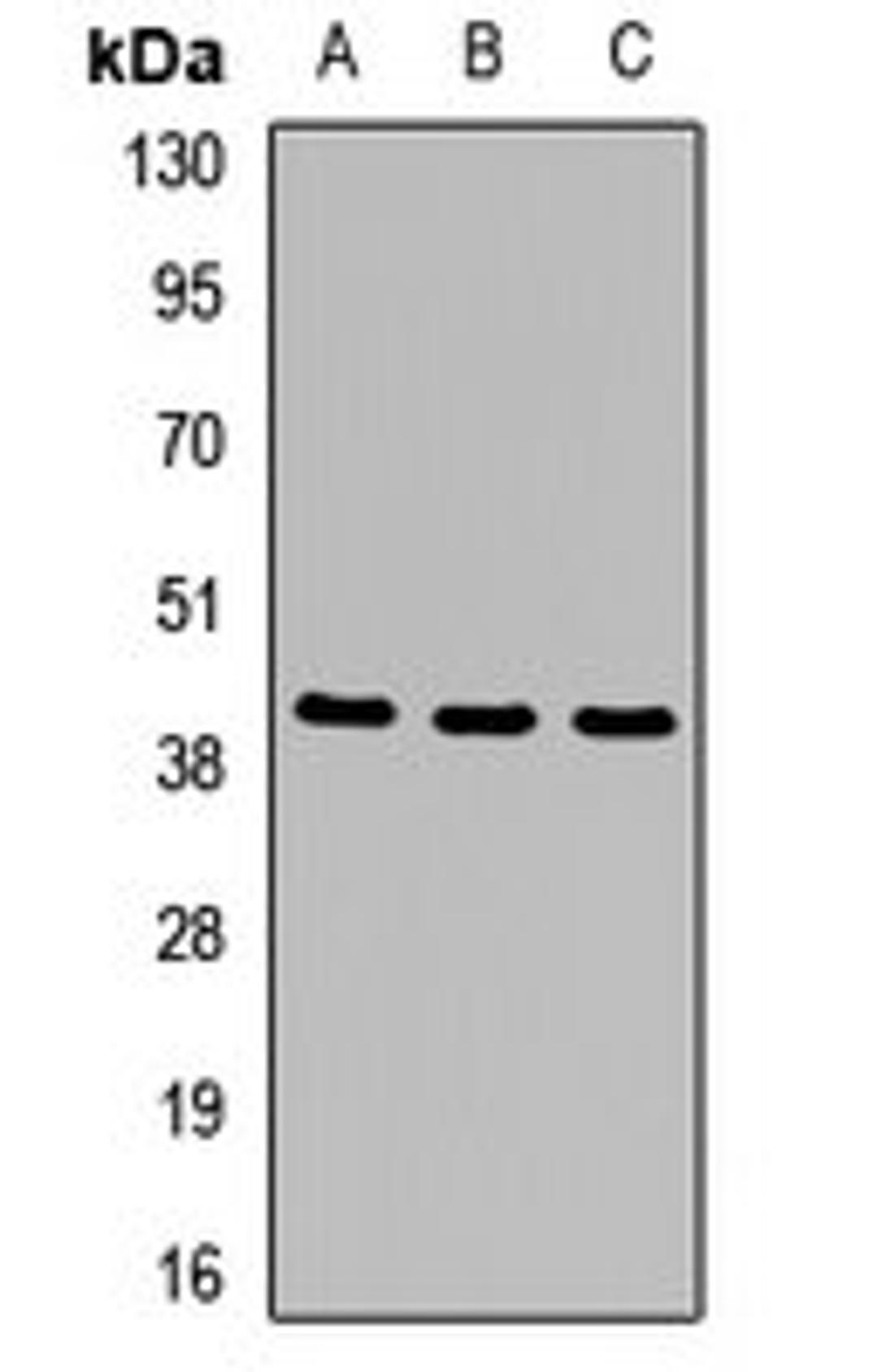 Western blot analysis of LO2 (Lane1), HT29 (Lane2), mouse pancreas (Lane3) whole cell lysates using MTHFD2 antibody