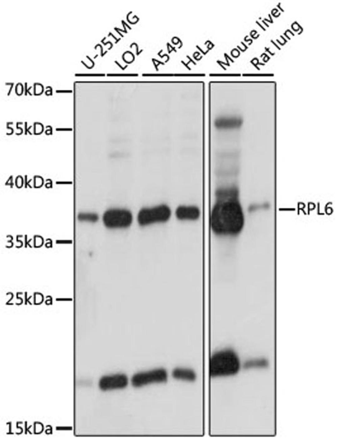 Western blot - RPL6 antibody (A15094)