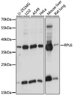 Western blot - RPL6 antibody (A15094)