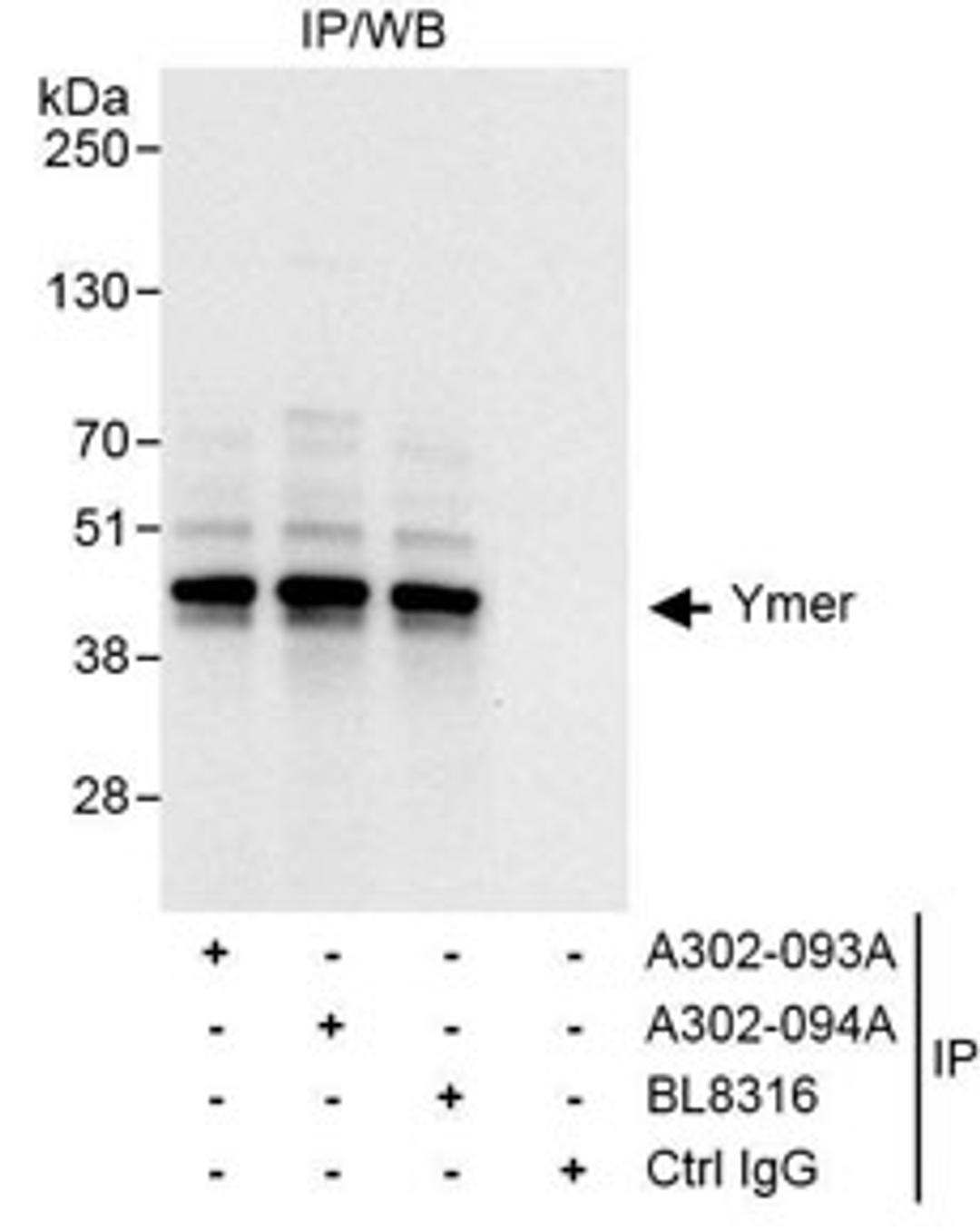 Detection of human Ymer by western blot of immunoprecipitates.