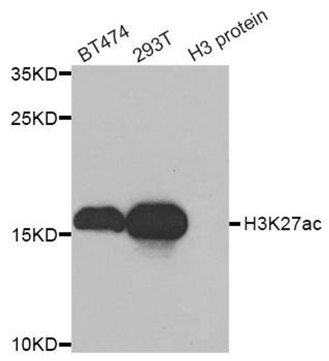 Western blot analysis of extracts of various cell lines using Acetyl-Histone H3-K27 antibody