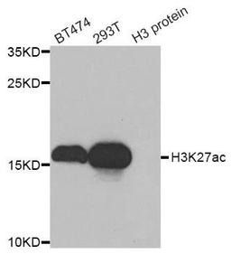 Western blot analysis of extracts of various cell lines using Acetyl-Histone H3-K27 antibody