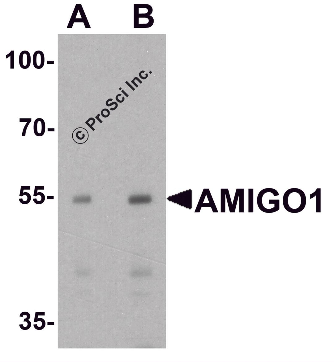 Western blot analysis of AMIGO1 in HeLa cell lysate with AMIGO1 antibody at (A) 1 and (B) 2 μg/ml.