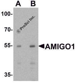 Western blot analysis of AMIGO1 in HeLa cell lysate with AMIGO1 antibody at (A) 1 and (B) 2 μg/ml.