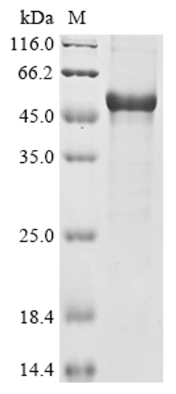 (Tris-Glycine gel) Discontinuous SDS-PAGE (reduced) with 5% enrichment gel and 15% separation gel.