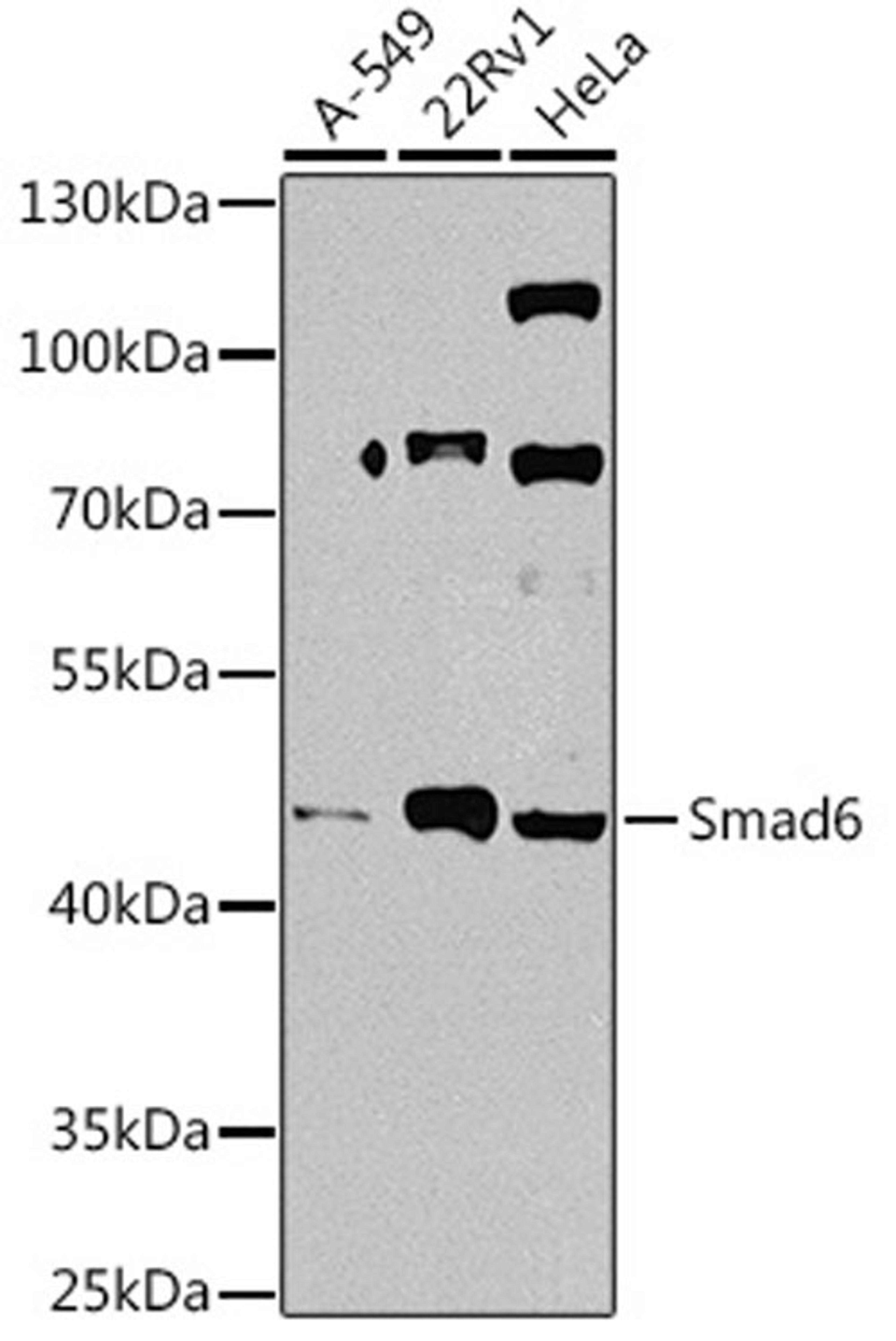 Western blot - Smad6 antibody (A14749)