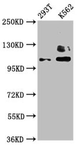 Western Blot. Positive WB detected in: 293T whole cell lysate, K562 whole cell lysate. All lanes: ZNF268 antibody at 4µg/ml. Secondary. Goat polyclonal to rabbit IgG at 1/50000 dilution. Predicted band size: 109, 90, 10, 12, 16, 6, 13 kDa. Observed band size: 109 kDa