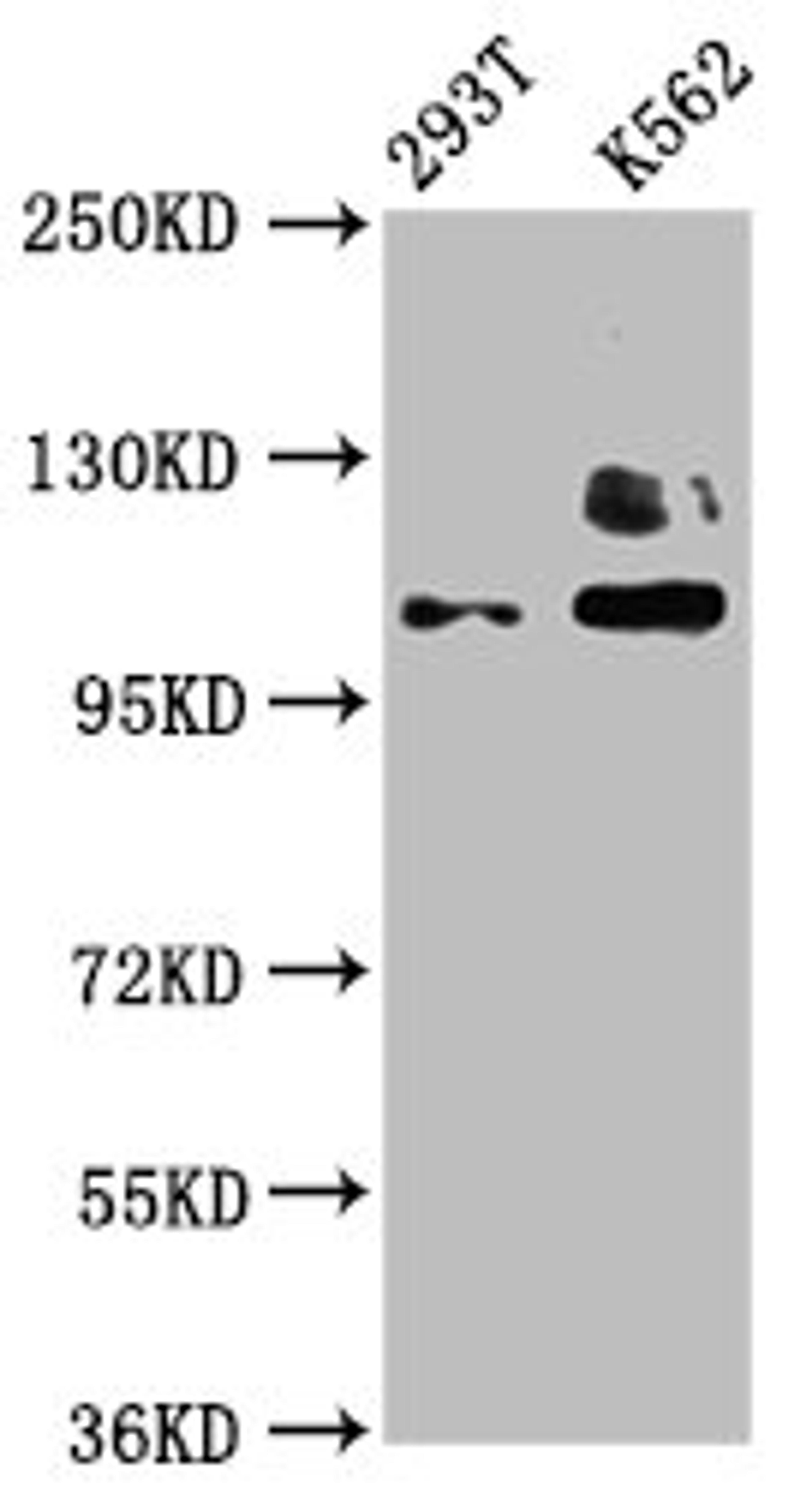 Western Blot. Positive WB detected in: 293T whole cell lysate, K562 whole cell lysate. All lanes: ZNF268 antibody at 4µg/ml. Secondary. Goat polyclonal to rabbit IgG at 1/50000 dilution. Predicted band size: 109, 90, 10, 12, 16, 6, 13 kDa. Observed band size: 109 kDa