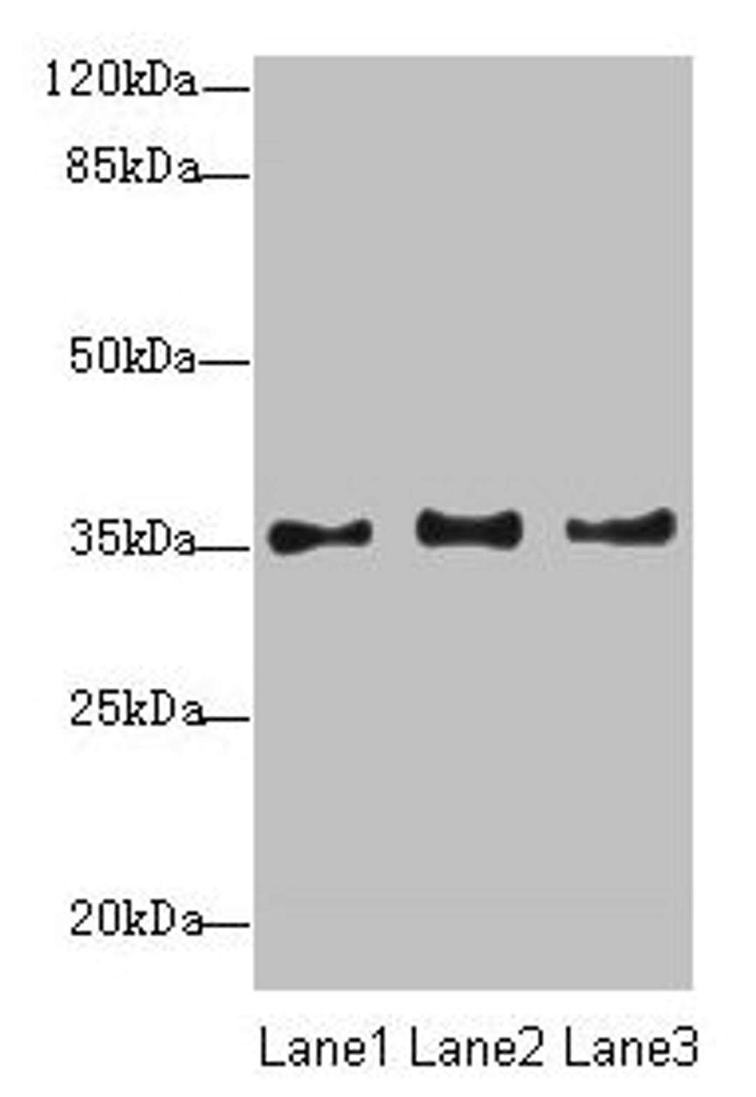 Western blot. All lanes: NUP35 antibody at 12µg/ml. Lane 1: Jurkat whole cell lysate. Lane 2: A431 whole cell lysate. Lane 3: HepG2 whole cell lysate. Secondary. Goat polyclonal to rabbit IgG at 1/10000 dilution. Predicted band size: 35, 34, 22 kDa. Observed band size: 35 kDa