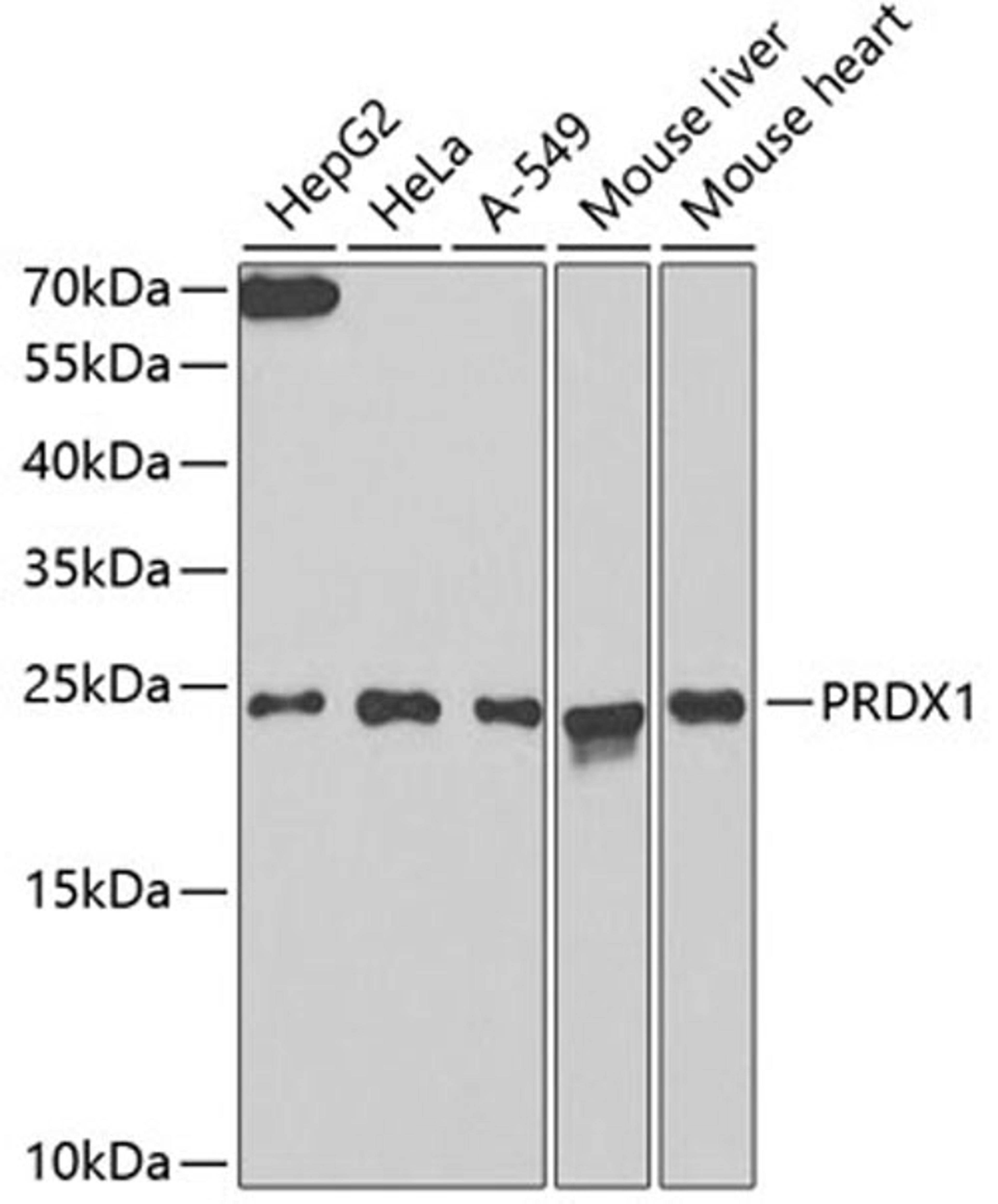Western blot - PRDX1 antibody (A13524)