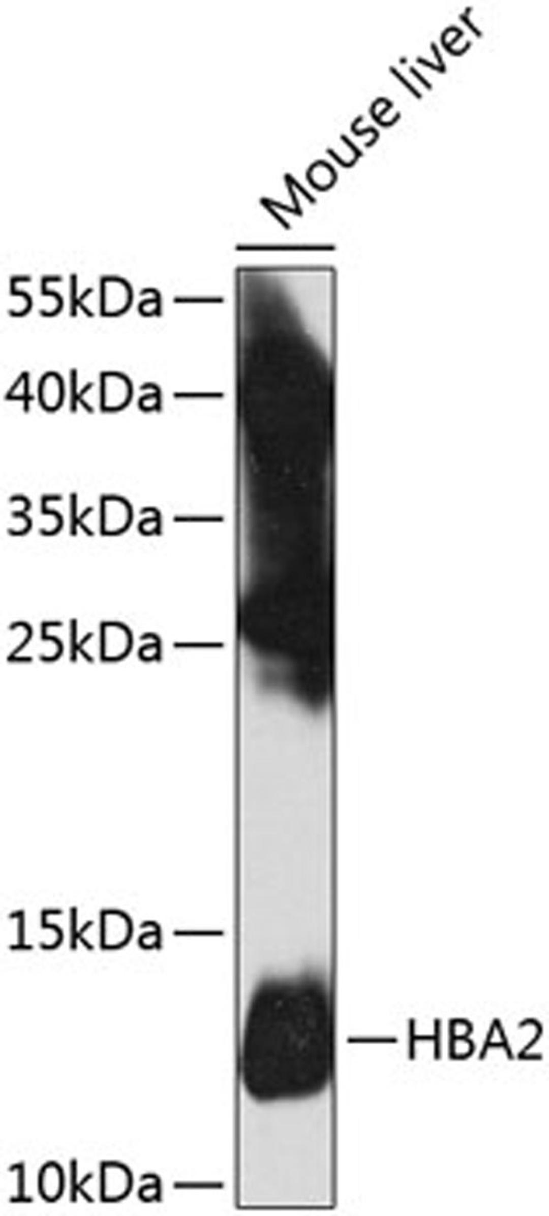 Western blot - HBA2 antibody (A8427)