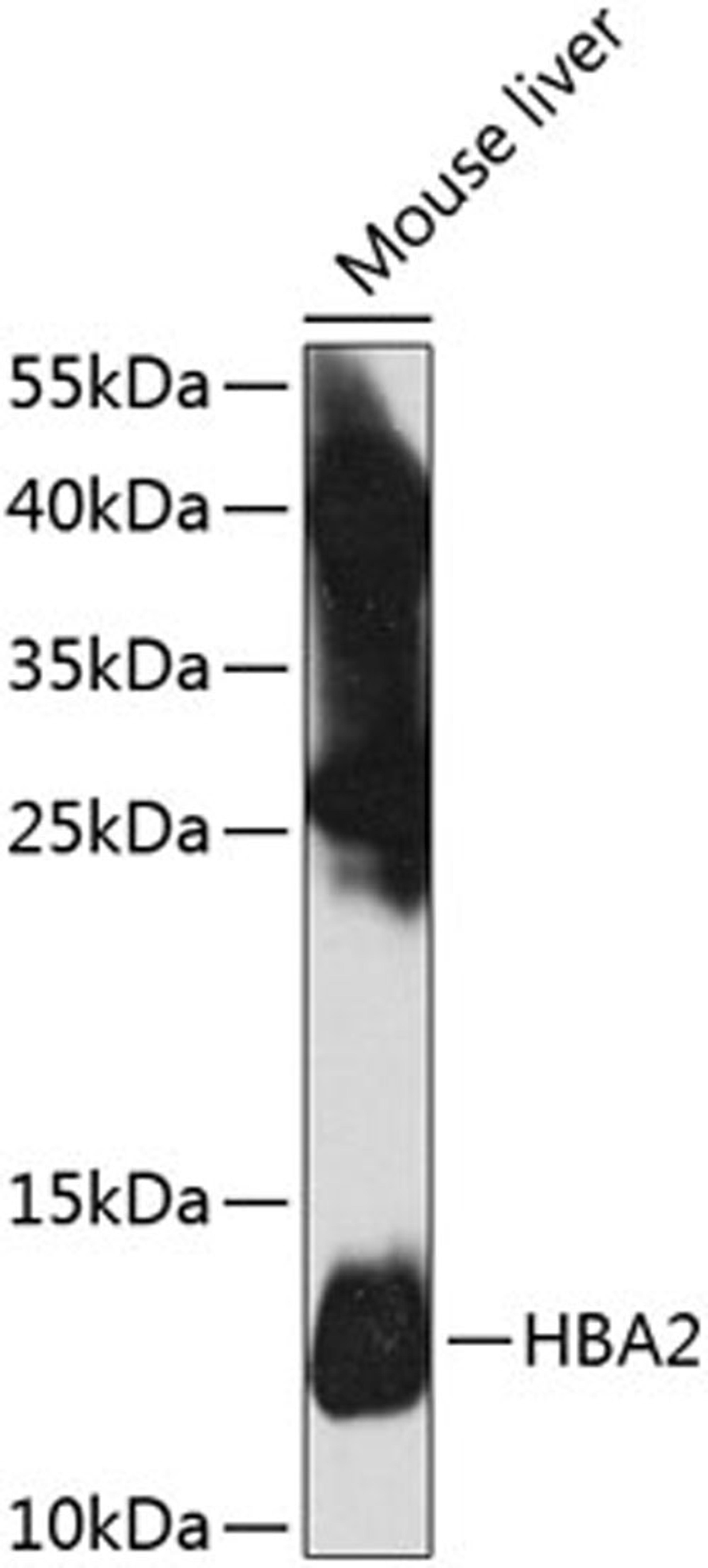 Western blot - HBA2 antibody (A8427)