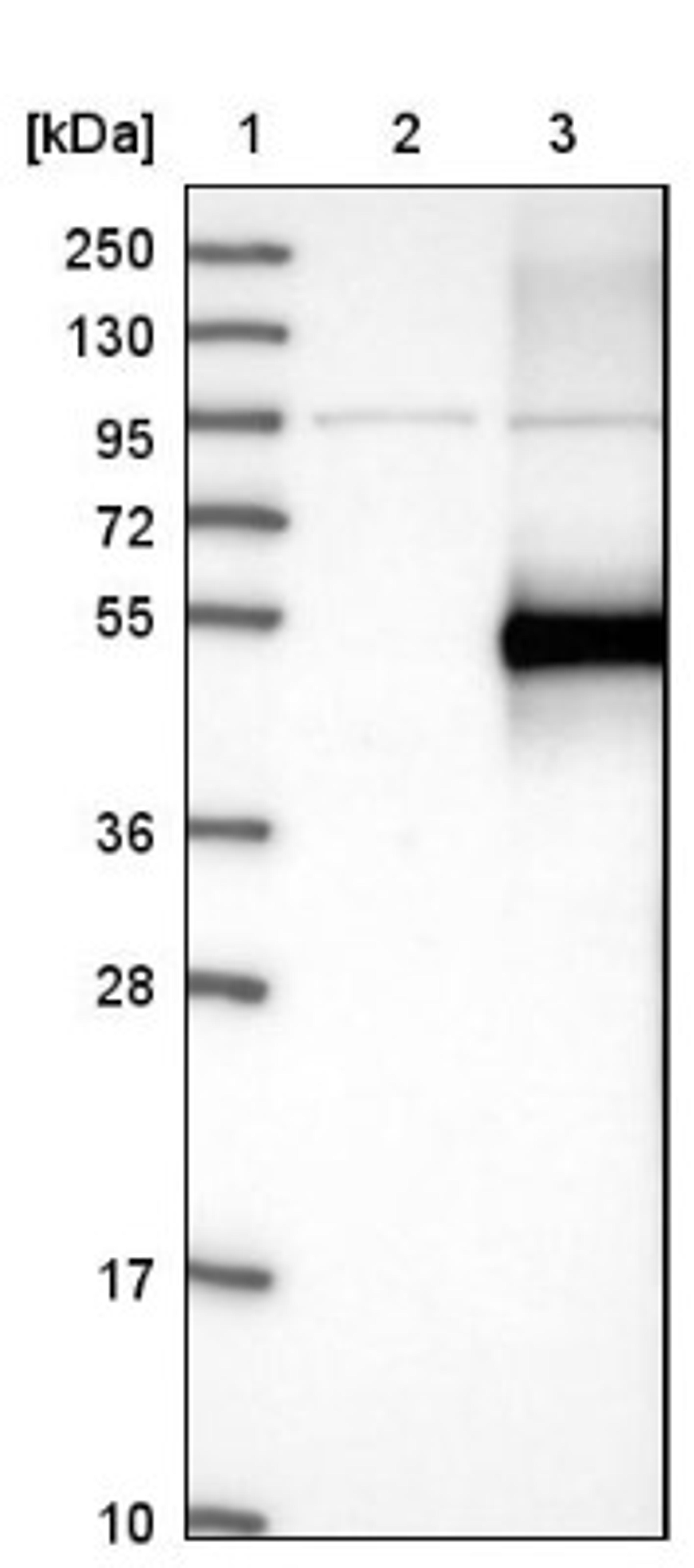 Western Blot: GFR alpha 3 Antibody [NBP1-89774] - Lane 1: Marker [kDa] 250, 130, 95, 72, 55, 36, 28, 17, 10<br/>Lane 2: Negative control (vector only transfected HEK293T lysate)<br/>Lane 3: Over-expression lysate (Co-expressed with a C-terminal myc-DDK tag (~3.1 kDa) in mammalian HEK293T cells, LY400574)