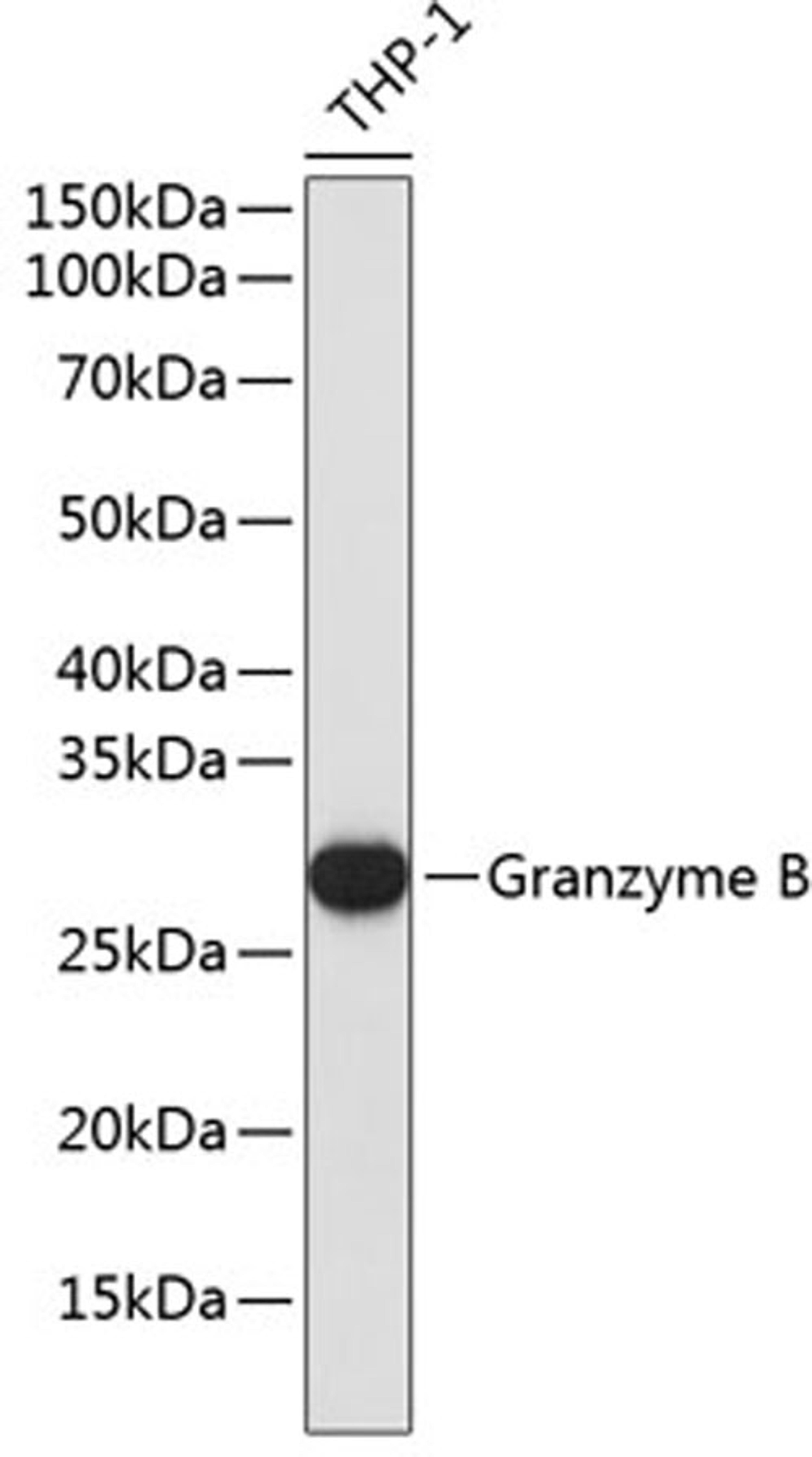 Western blot - Granzyme B antibody (A19592)