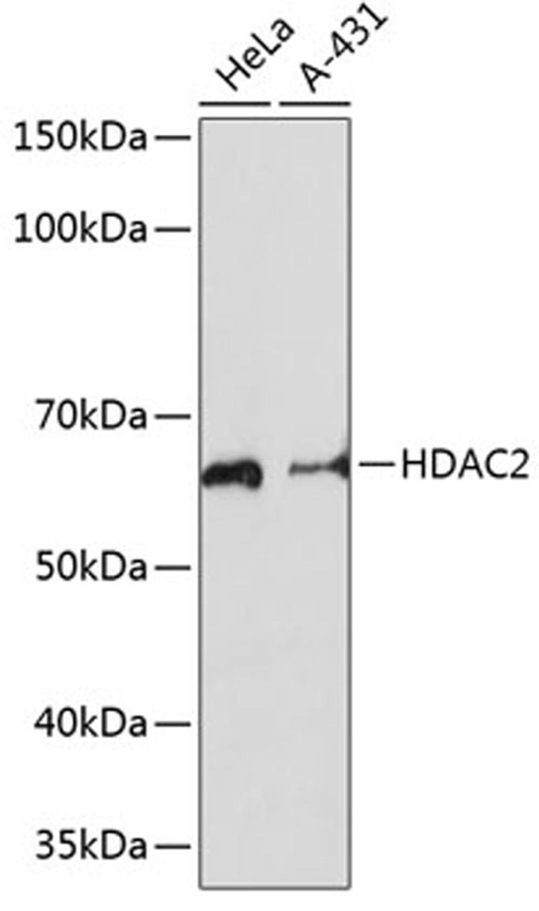 Western blot - HDAC2 antibody (A19626)