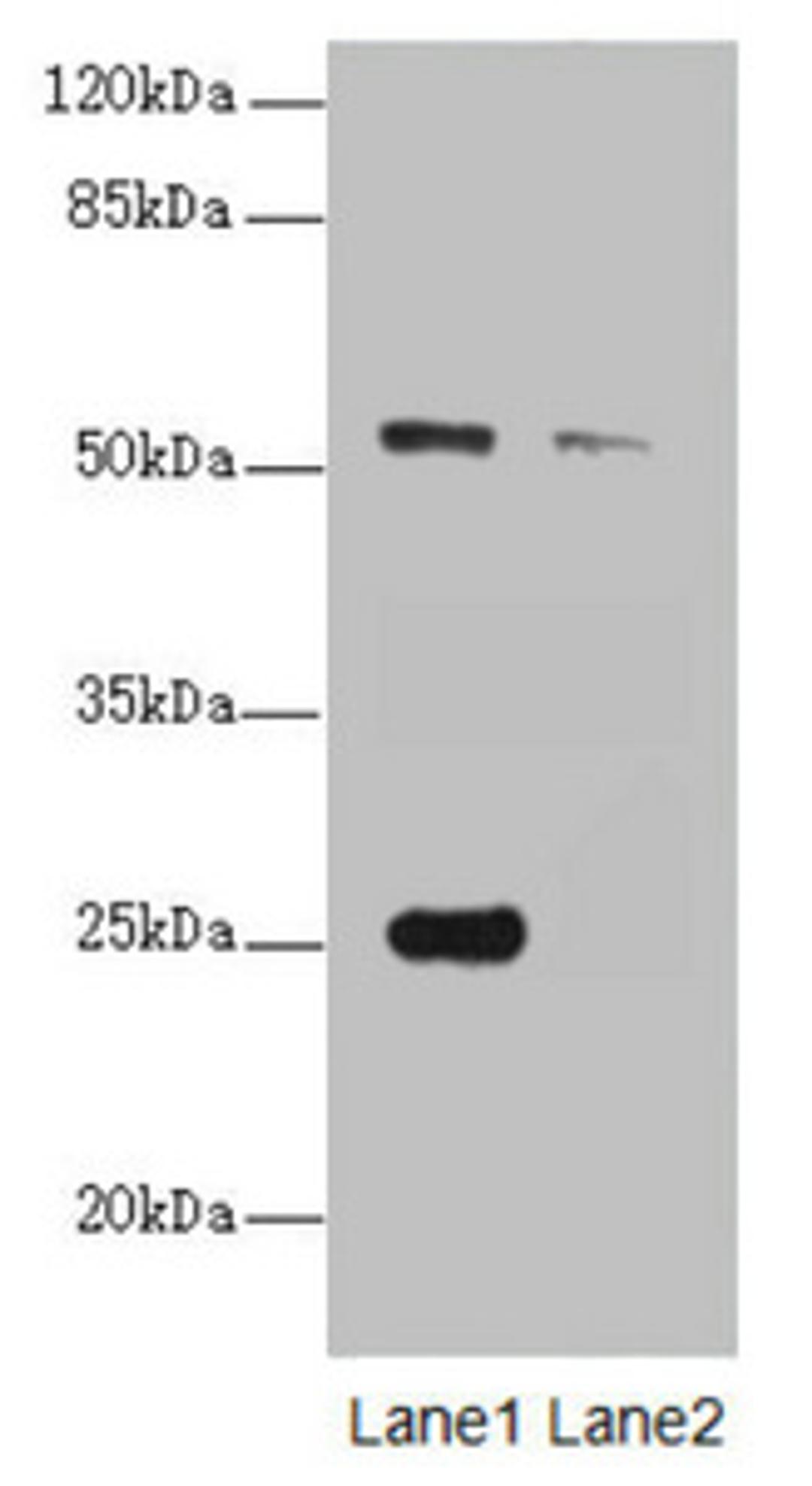 Western blot. All lanes: ERO1L antibody at 1.25ug/ml. Lane 1: A431 whole cell lysate. Lane 2: 293T whole cell lysate. Secondary. Goat polyclonal to rabbit IgG at 1/10000 dilution. Predicted band size: 54 kDa. Observed band size: 54, 25 kDa. 