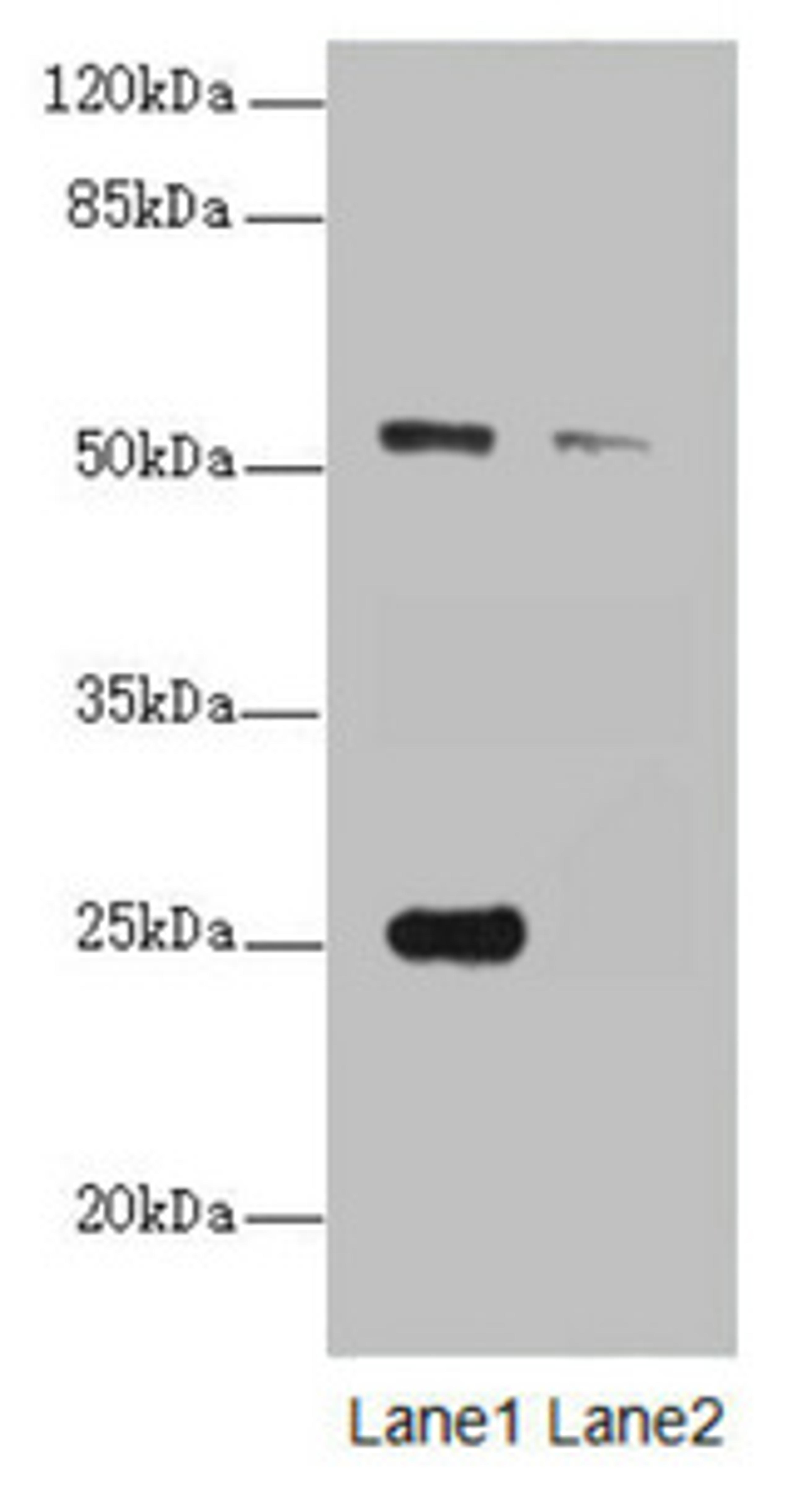 Western blot. All lanes: ERO1L antibody at 1.25ug/ml. Lane 1: A431 whole cell lysate. Lane 2: 293T whole cell lysate. Secondary. Goat polyclonal to rabbit IgG at 1/10000 dilution. Predicted band size: 54 kDa. Observed band size: 54, 25 kDa. 