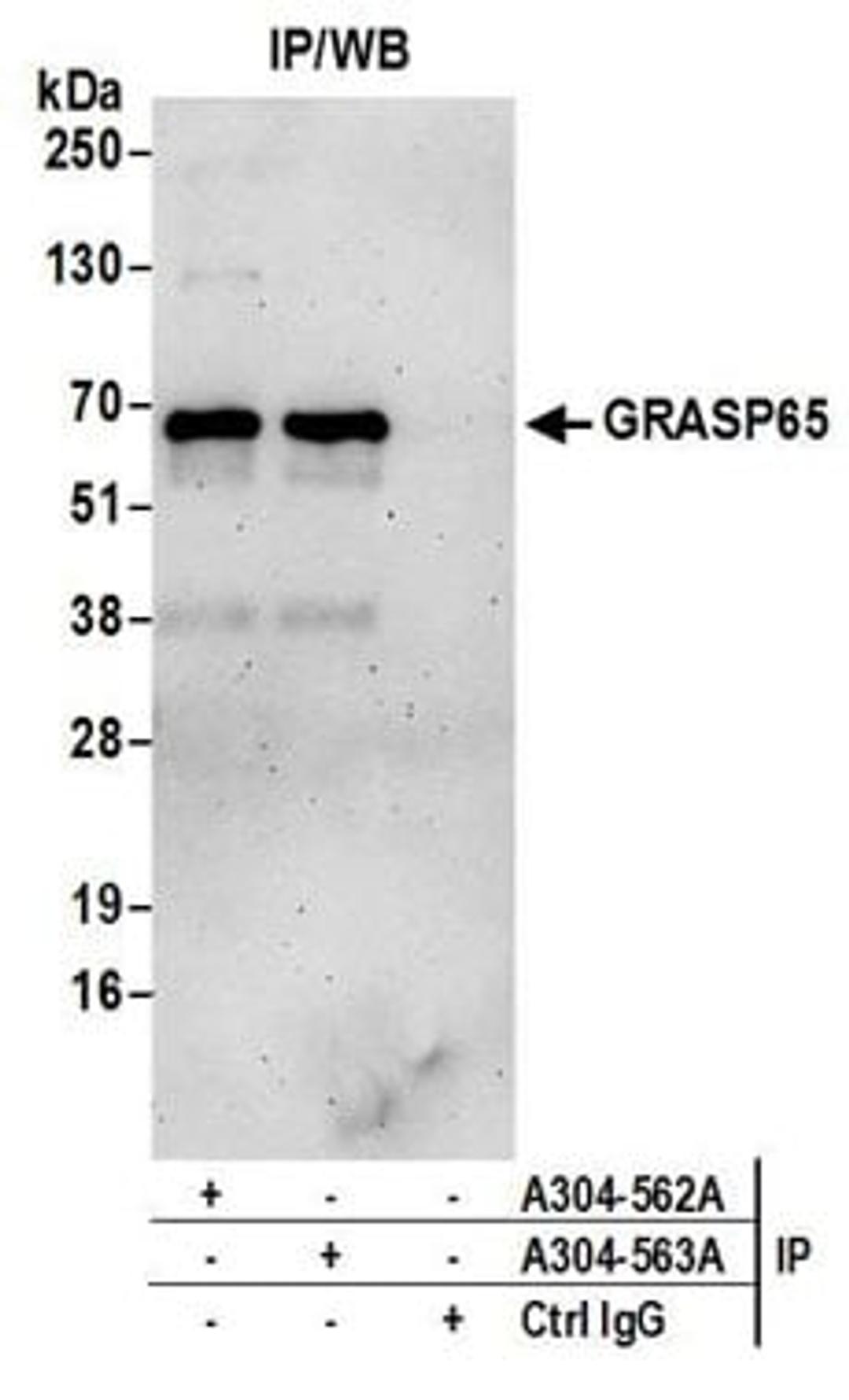 Detection of human GRASP65 by western blot of immunoprecipitates.