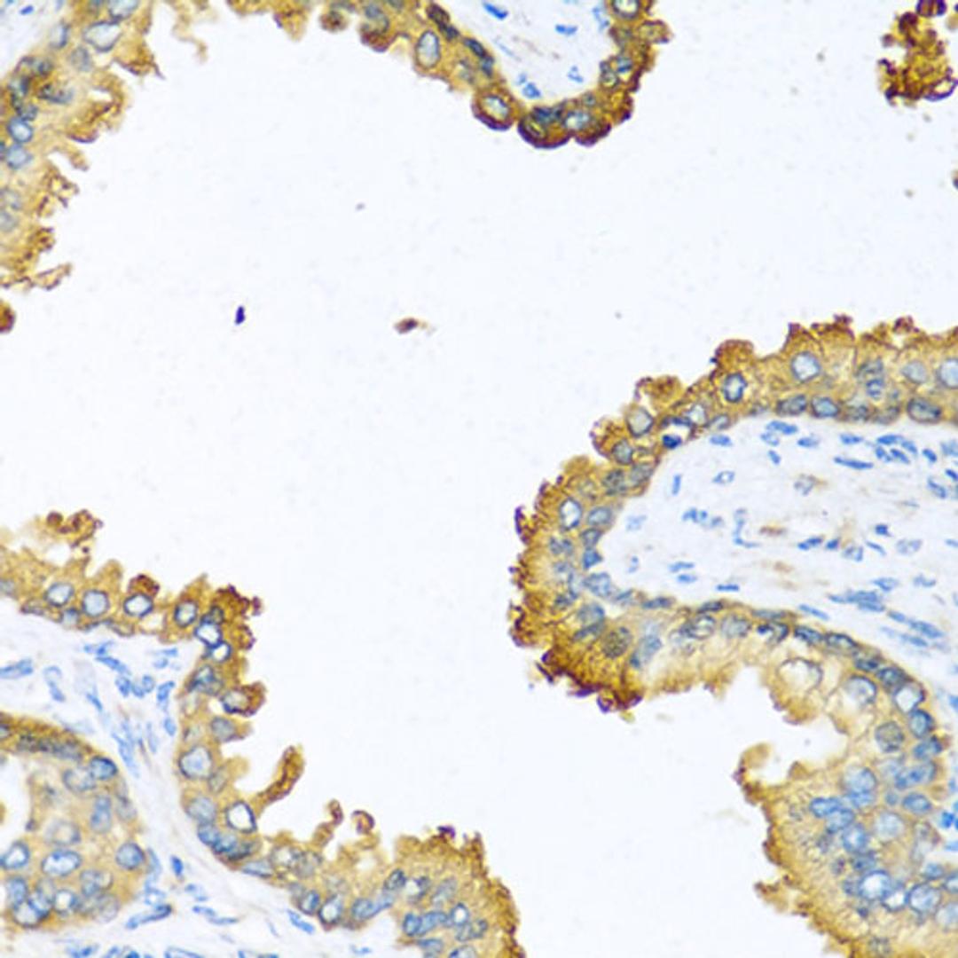 Immunohistochemistry  - VEGFC antibody (A12530)