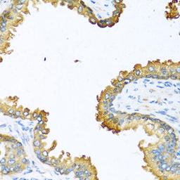 Immunohistochemistry  - VEGFC antibody (A12530)