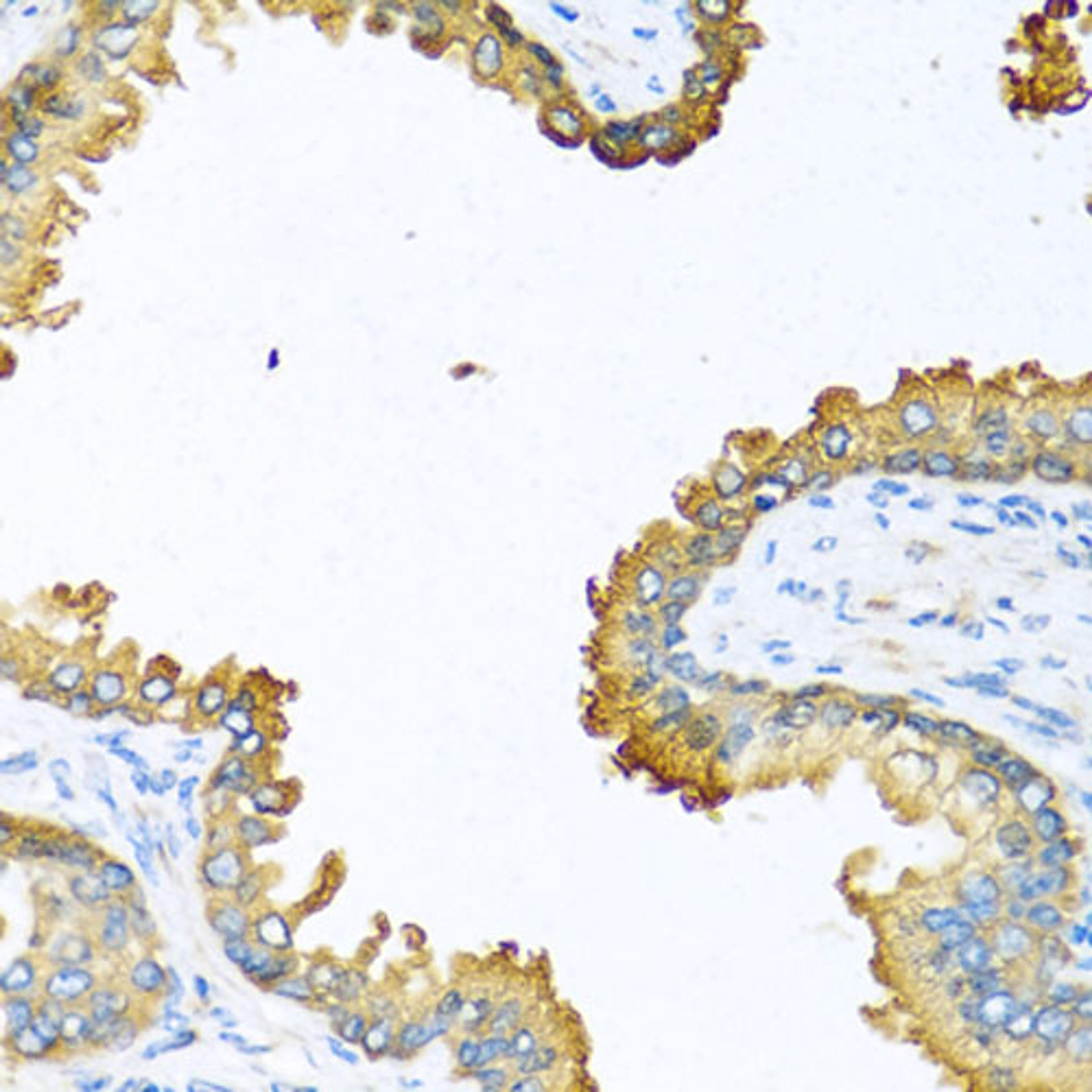 Immunohistochemistry - VEGFC antibody (A12530)