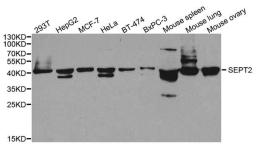 Western blot analysis of extracts of various cell lines using SEPT2 antibody