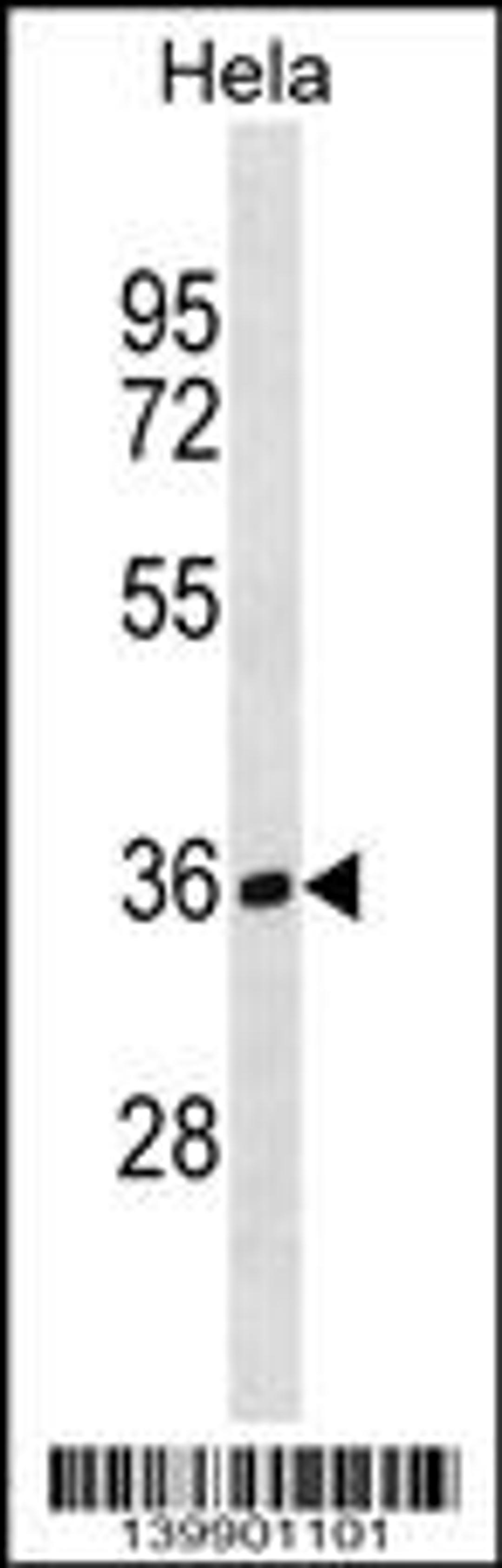 Western blot analysis in Hela cell line lysates (35ug/lane).