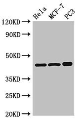 Western Blot. Positive WB detected in: Hela whole cell lysate, MCF-7 whole cell lysate, PC-3 whole cell lysate. All lanes: PRKAR2A antibody at 2.5µg/ml. Secondary. Goat polyclonal to rabbit IgG at 1/50000 dilution. Predicted band size: 46, 44 kDa. Observed band size: 46 kDa